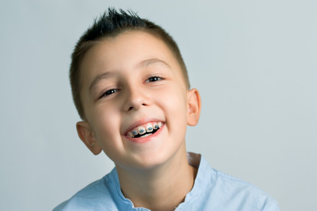 Young boy smiling and wearing braces posing in front of blue background