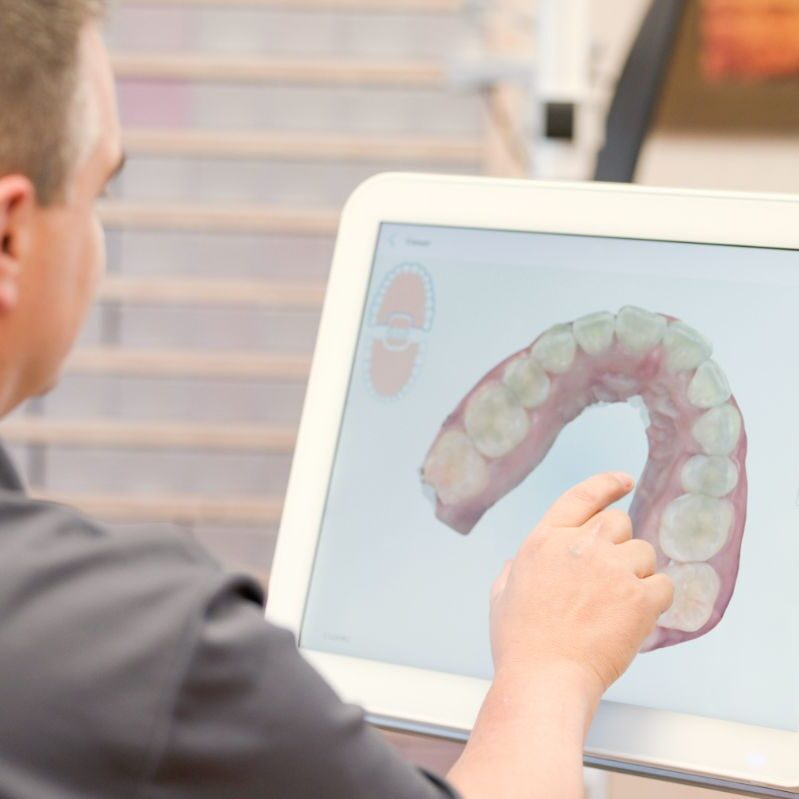 Invisalign: Fact or Fiction